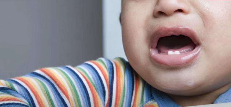 Do Babies' Gums Bleed When They Teeth
