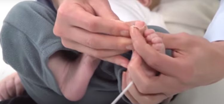 How to Put Pulse Oximeter on Baby Foot